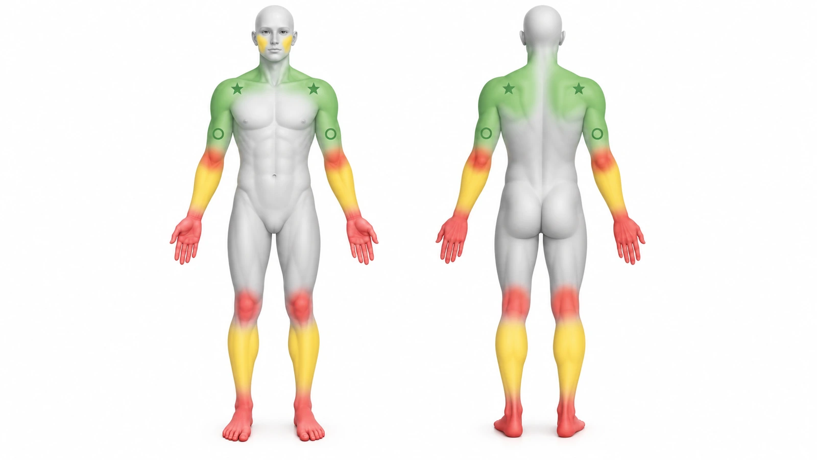Sagome anteriore e posteriore del corpo con codice colore: verde su spalle, parte alta della schiena e interno degli avambracci, giallo su esterno degli avambracci e polpacci, rosso su mani, dita, polsi, gomiti, ginocchia e piedi